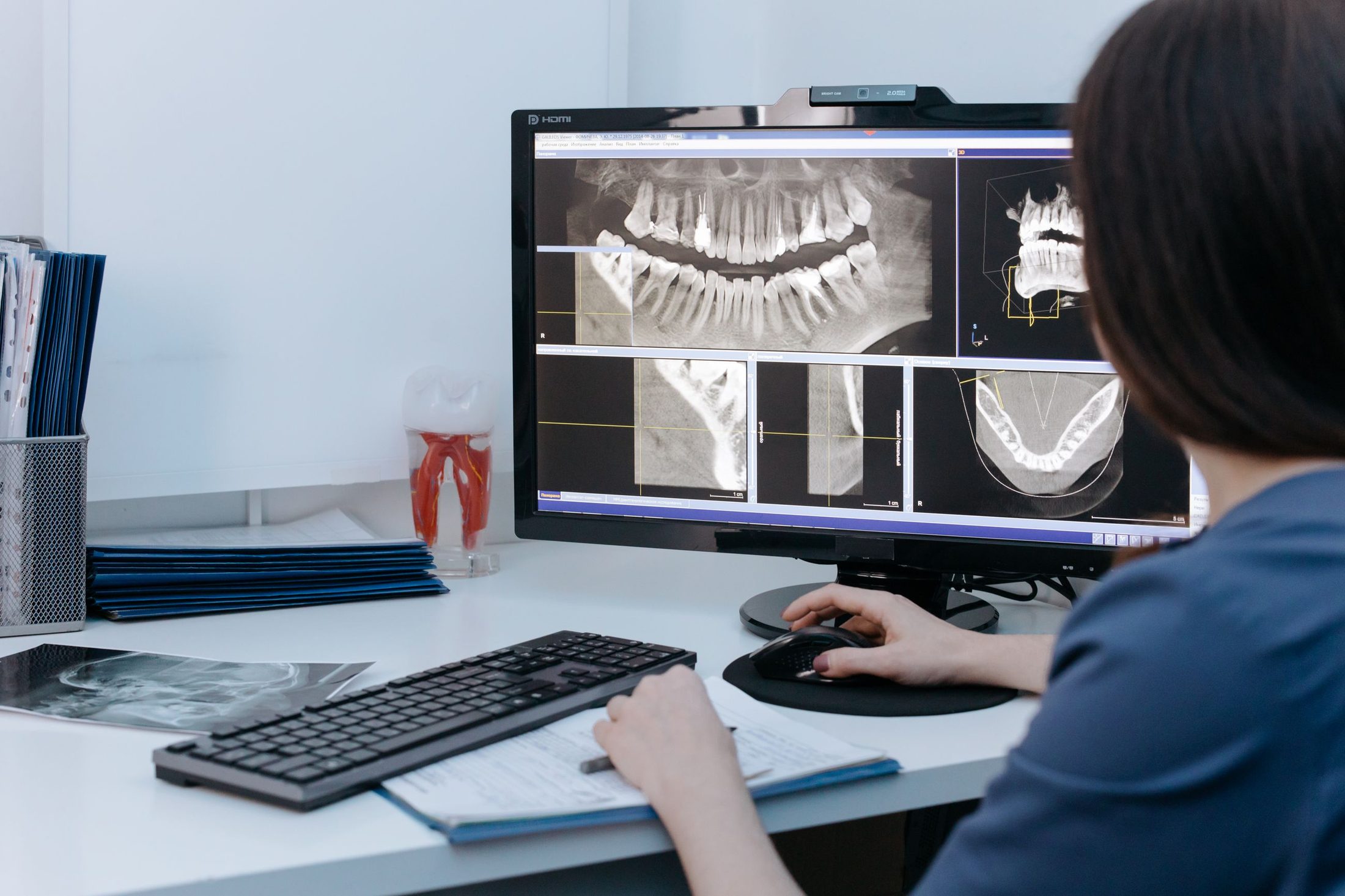 A dentist reviewing cone-beam CT views and an X-ray of the jaw on screen