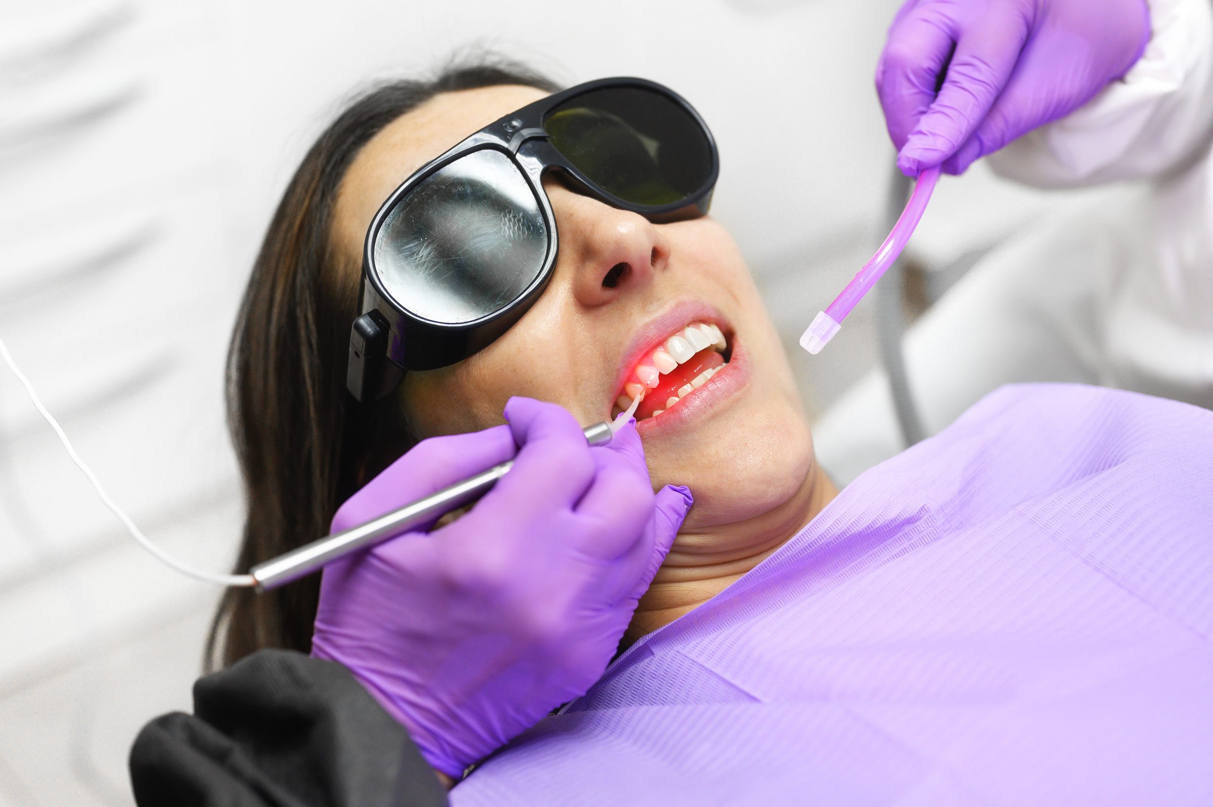 Laser treatment along the gum line