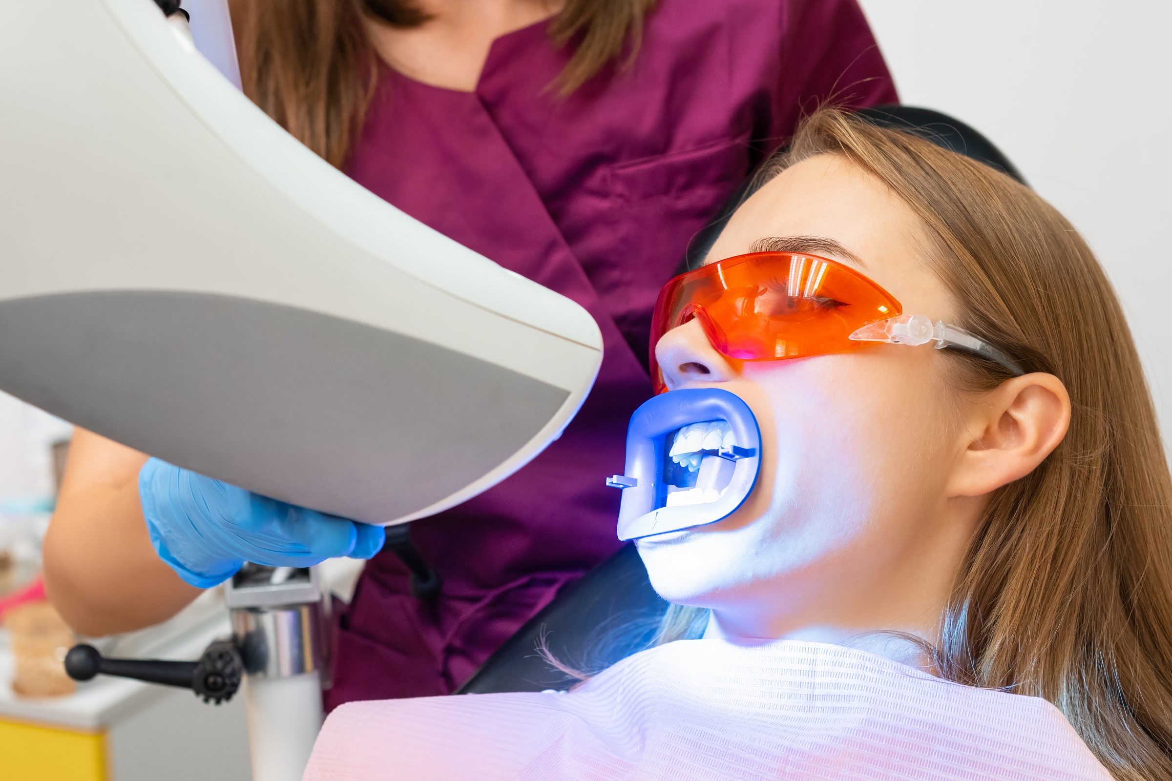 Professional teeth whitening in the chair