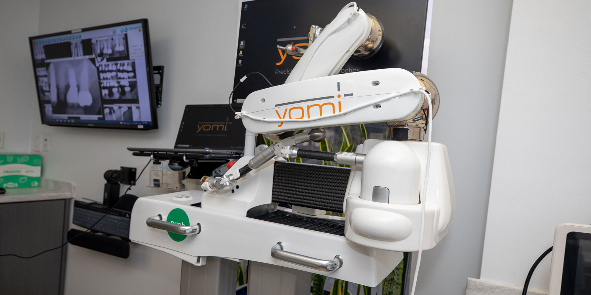 Yomi robotic guidance at West LA Implants