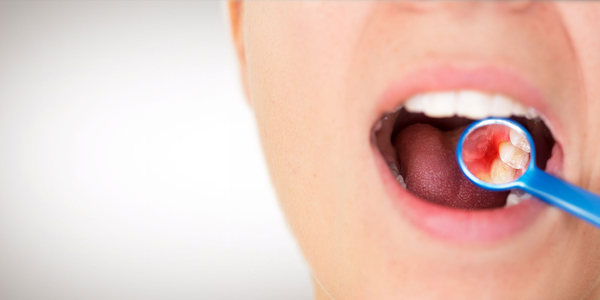 A patient being examined for gum disease