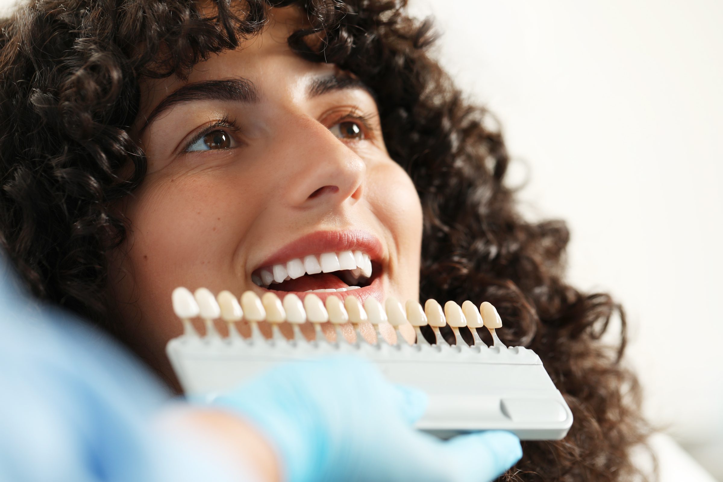 A veneer shade guide held against a smile