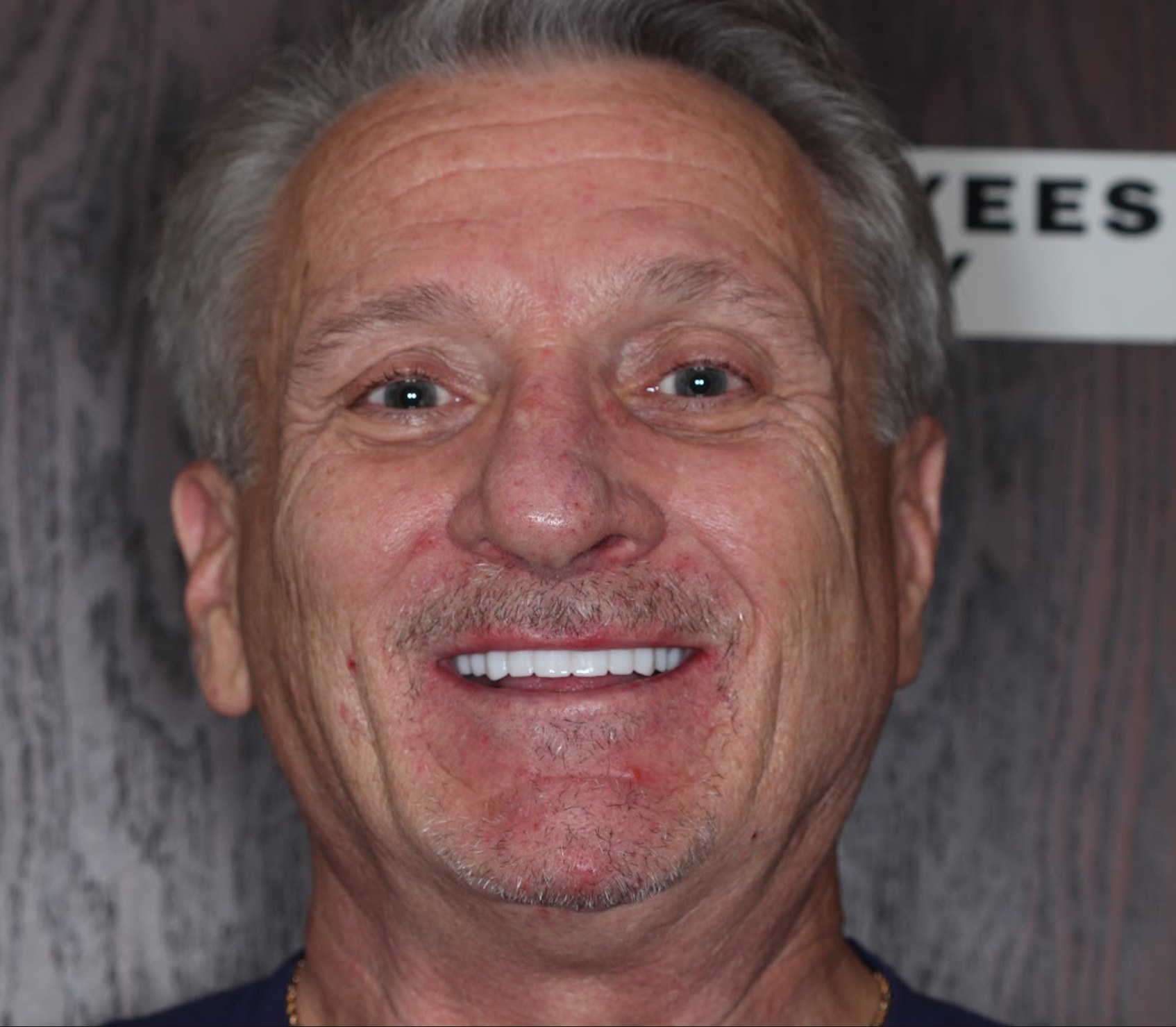 A West LA Implants patient smiling after his treatment