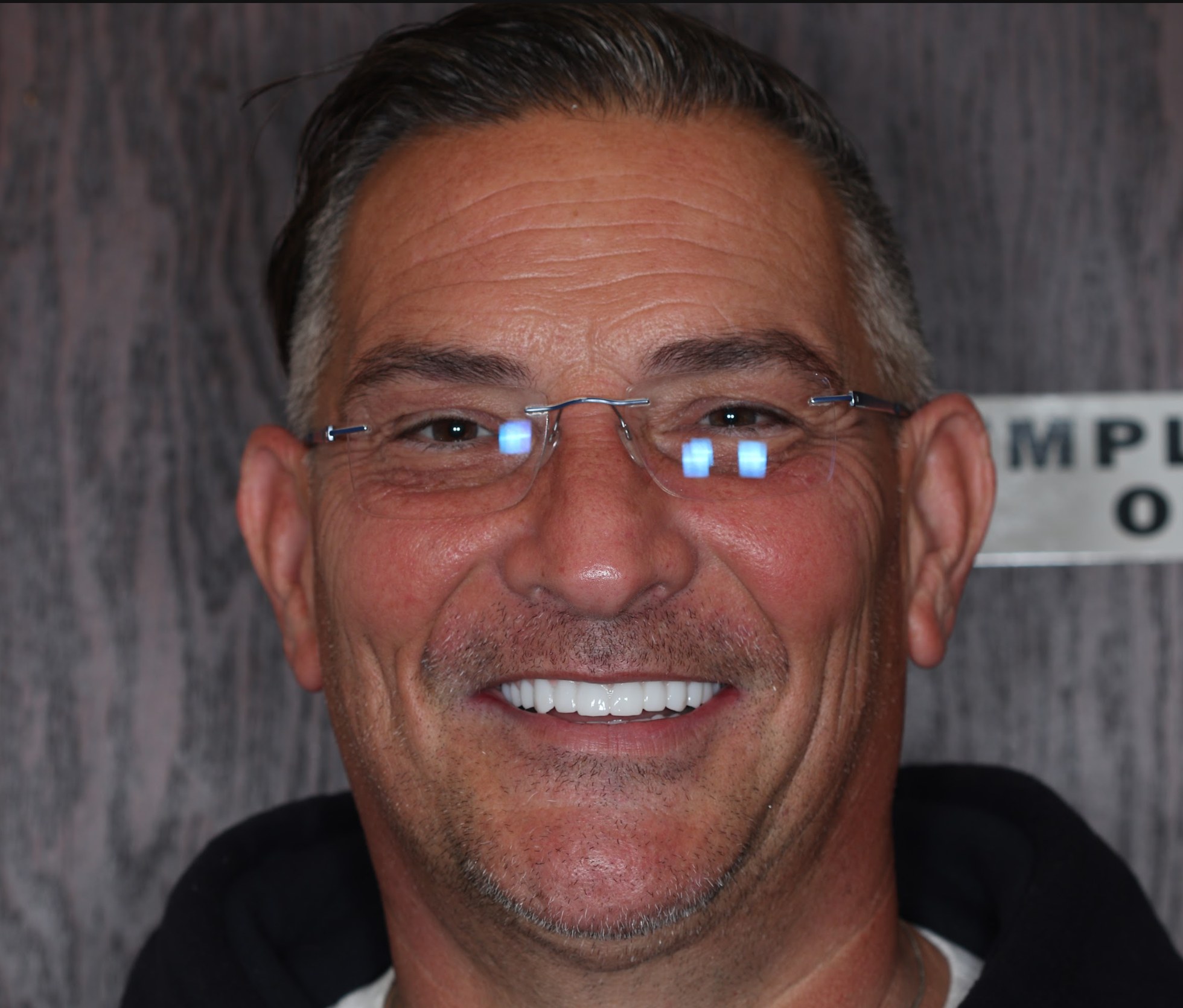 A West LA Implants patient smiling after his implant treatment