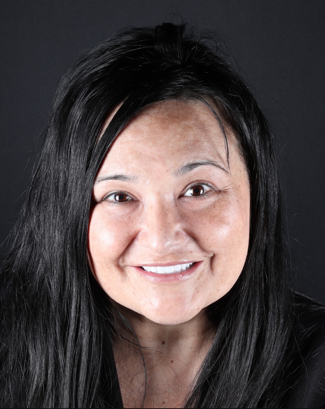 A West LA Implants patient smiling after her treatment